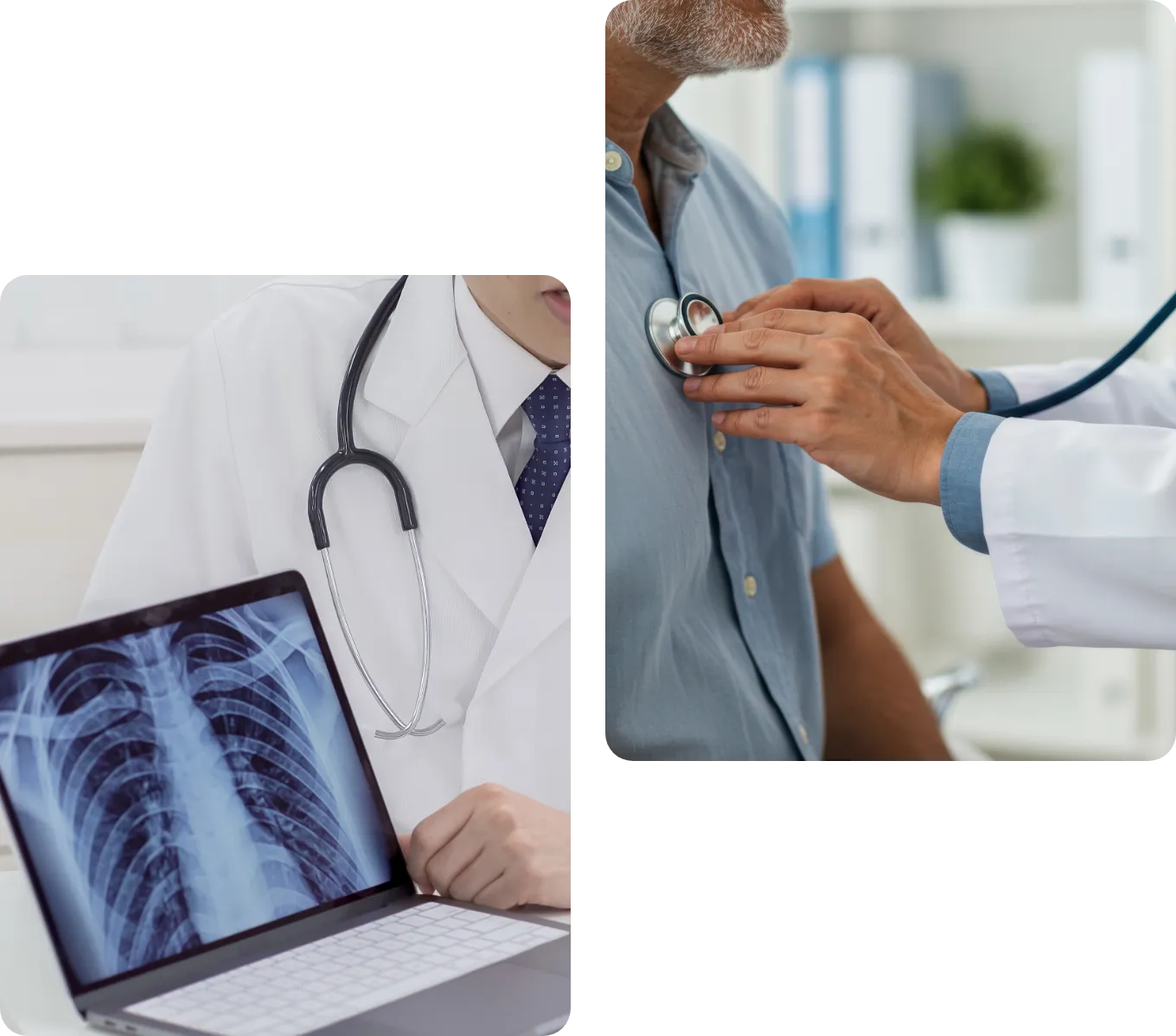 肺がんの早期治療の重要性