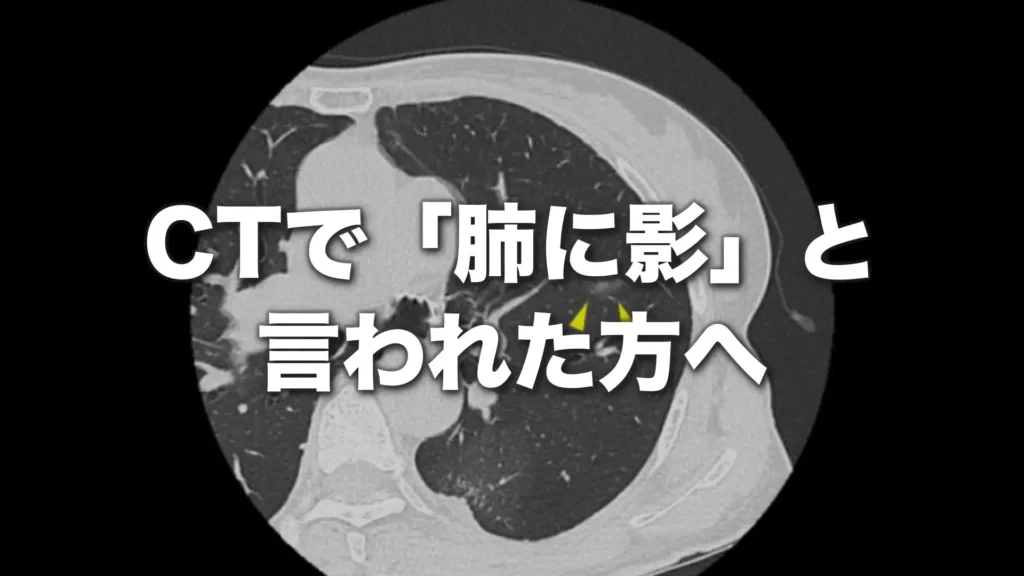 CTで「肺に影」と言われた方へ