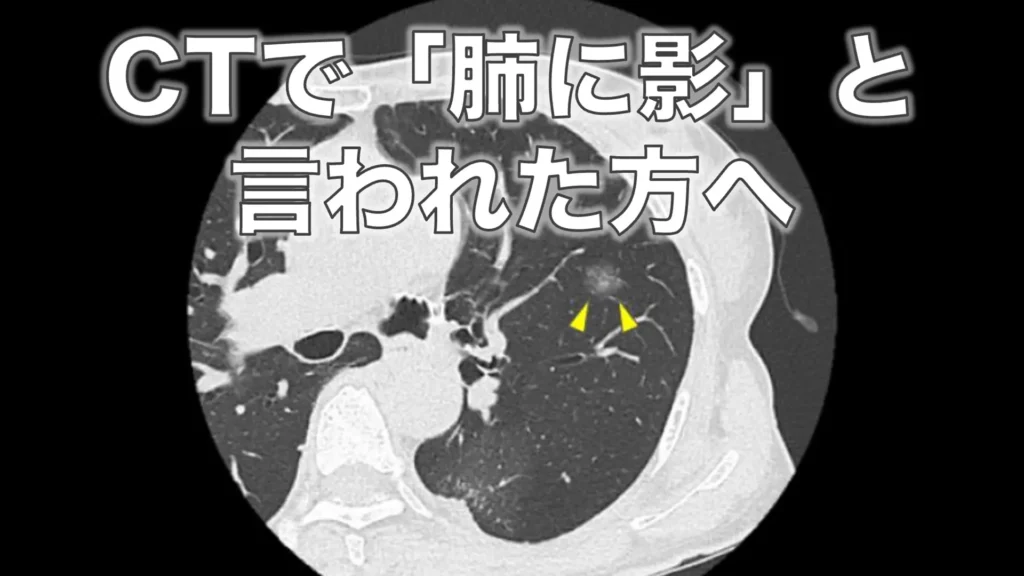 CTで「肺に影」と言われた方へ