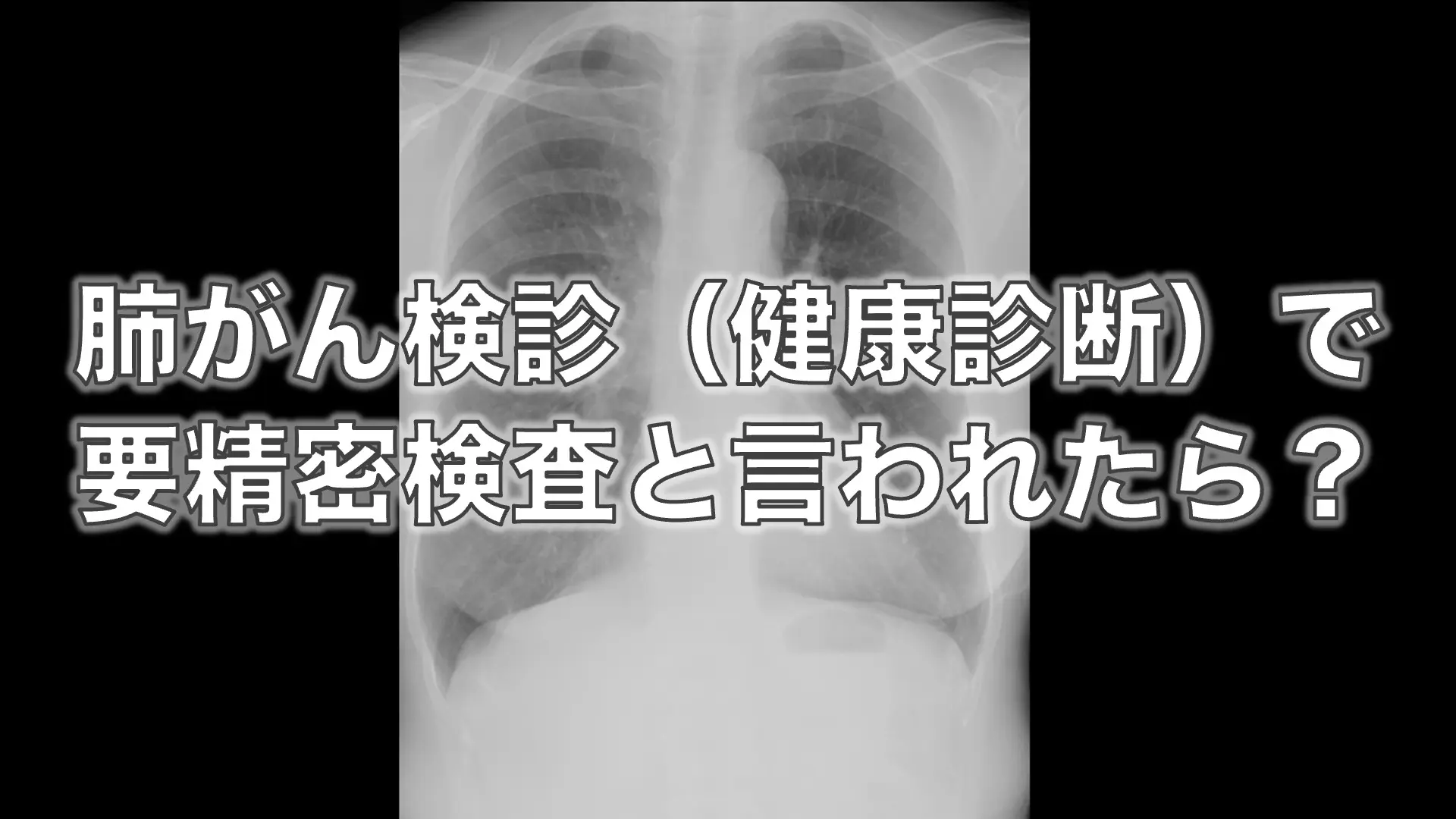 肺がん 検診 で ひっかかっ た