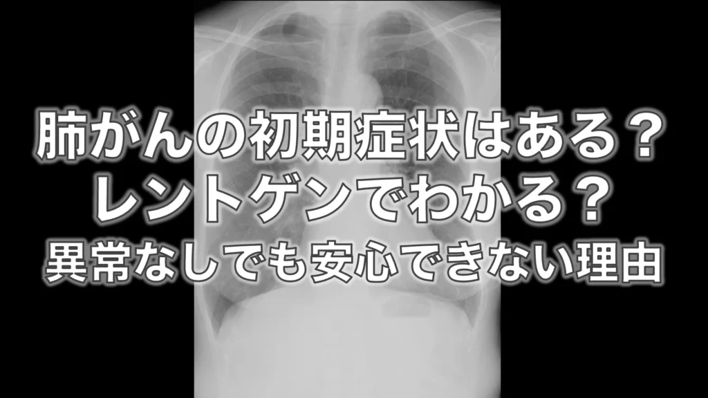 肺がんの初期症状はある？レントゲンでわかる？