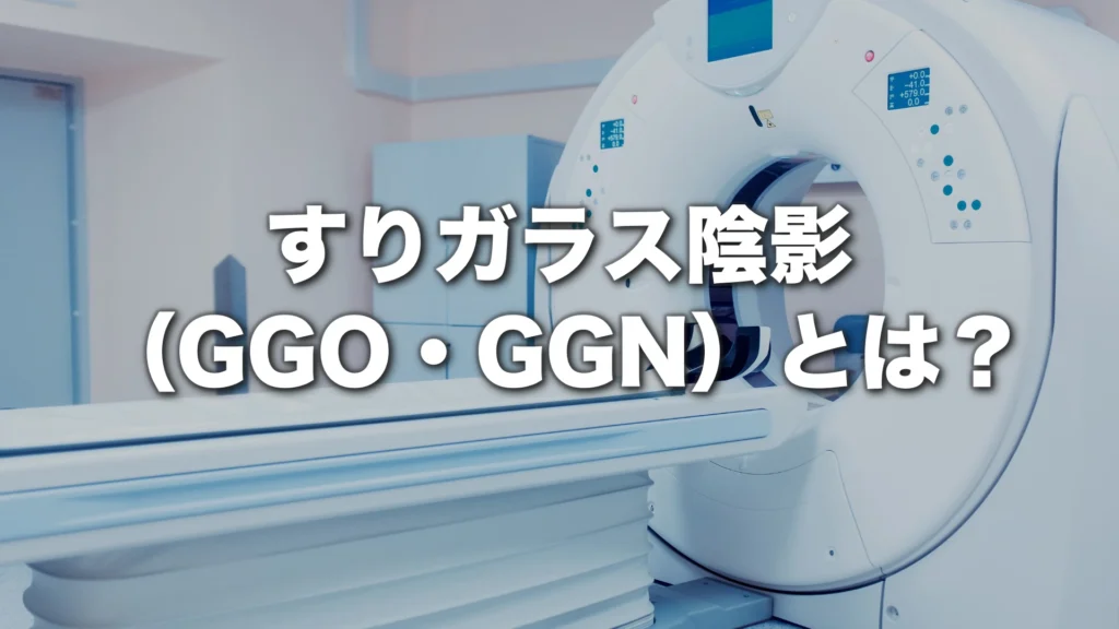 すりガラス陰影（GGO・GGN）とは？